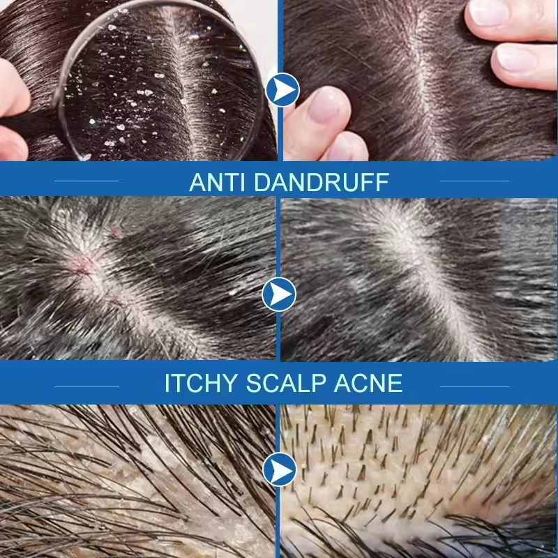 Hızlı Kepek Önleyici Saç Bakım - Castor Oil Soap incelemesi ve fiyatı